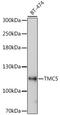 Transmembrane Channel Like 5 antibody, A14593, Boster Biological Technology, Western Blot image 