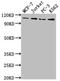 Lysine Demethylase 1A antibody, CSB-RA222329A0HU, Cusabio, Western Blot image 