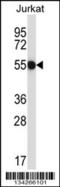 CCR4-NOT Transcription Complex Subunit 2 antibody, 57-581, ProSci, Western Blot image 