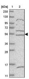 Zinc Finger Protein 232 antibody, NBP1-86822, Novus Biologicals, Western Blot image 