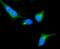 Protein Kinase CAMP-Dependent Type II Regulatory Subunit Alpha antibody, A03911-2, Boster Biological Technology, Immunofluorescence image 