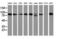 Protein Kinase C Epsilon antibody, LS-C172683, Lifespan Biosciences, Western Blot image 