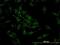 Cofilin 2 antibody, H00001073-M03, Novus Biologicals, Immunocytochemistry image 