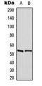 Myocyte Enhancer Factor 2A antibody, LS-C354034, Lifespan Biosciences, Western Blot image 