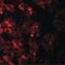 Transmembrane Protein 106B antibody, PA5-34353, Invitrogen Antibodies, Immunofluorescence image 