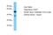 DDB1 And CUL4 Associated Factor 7 antibody, PA5-43770, Invitrogen Antibodies, Western Blot image 