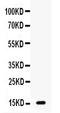 Gastric Inhibitory Polypeptide antibody, PB9947, Boster Biological Technology, Western Blot image 