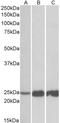 Troponin I, fast skeletal muscle antibody, STJ72983, St John