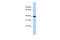 Phospholipid Phosphatase Related 5 antibody, 25-982, ProSci, Enzyme Linked Immunosorbent Assay image 