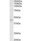 Actin Related Protein 2/3 Complex Subunit 1A antibody, orb12391, Biorbyt, Western Blot image 