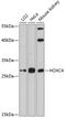 Homeobox C4 antibody, GTX66549, GeneTex, Western Blot image 