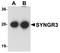 Synaptogyrin 3 antibody, A14692, Boster Biological Technology, Western Blot image 