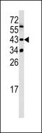 Lysine Methyltransferase 5A antibody, MBS9201140, MyBioSource, Western Blot image 