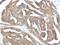 Gonadotropin Releasing Hormone Receptor antibody, M01442, Boster Biological Technology, Immunohistochemistry paraffin image 