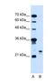 Motile Sperm Domain Containing 3 antibody, NBP1-60035, Novus Biologicals, Western Blot image 
