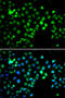 Metal Response Element Binding Transcription Factor 2 antibody, STJ29157, St John