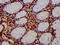 CutC Copper Transporter antibody, LS-C672188, Lifespan Biosciences, Immunohistochemistry paraffin image 