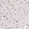 Histone Cluster 1 H2A Family Member M antibody, AMAb91335, Atlas Antibodies, Immunohistochemistry paraffin image 