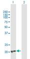 Core-Binding Factor Subunit Beta antibody, H00000865-B01P, Novus Biologicals, Western Blot image 