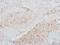 Cyclin Dependent Kinase 1 antibody, NBP2-78838, Novus Biologicals, Immunohistochemistry paraffin image 