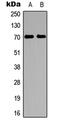 Ribosomal Protein S6 Kinase B1 antibody, LS-C358316, Lifespan Biosciences, Western Blot image 