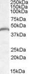 Patatin Like Phospholipase Domain Containing 3 antibody, EB08402, Everest Biotech, Western Blot image 