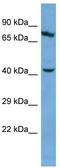 Keratin 83 antibody, TA334055, Origene, Western Blot image 