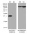 Ubiquitin C-Terminal Hydrolase L1 antibody, LS-C797036, Lifespan Biosciences, Western Blot image 