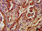 Protein Kinase C Eta antibody, LS-C394617, Lifespan Biosciences, Immunohistochemistry paraffin image 