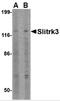 SLIK3 antibody, 4463, ProSci, Western Blot image 