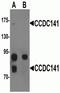 Coiled-Coil Domain Containing 141 antibody, NBP2-81896, Novus Biologicals, Western Blot image 