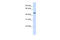 Jumonji domain-containing protein 5 antibody, 27-137, ProSci, Enzyme Linked Immunosorbent Assay image 