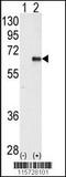 Protein Kinase AMP-Activated Catalytic Subunit Alpha 2 antibody, 62-890, ProSci, Western Blot image 