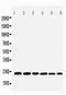 Synaptosome Associated Protein 23 antibody, PA1774, Boster Biological Technology, Western Blot image 