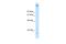 Zinc Finger Protein 318 antibody, A11267, Boster Biological Technology, Western Blot image 