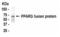 Peroxisome Proliferator Activated Receptor Gamma antibody, XW-7451, ProSci, Western Blot image 