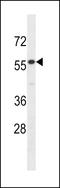 Interleukin 17 Receptor E antibody, LS-C157832, Lifespan Biosciences, Western Blot image 