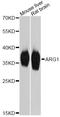 Arginase 1 antibody, A1847, ABclonal Technology, Western Blot image 
