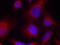 Myristoylated Alanine Rich Protein Kinase C Substrate antibody, STJ22279, St John