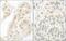 General Transcription Factor IIA Subunit 1 antibody, NBP1-46216, Novus Biologicals, Immunohistochemistry frozen image 
