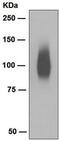Solute Carrier Family 4 Member 1 (Diego Blood Group) antibody, ab108414, Abcam, Western Blot image 