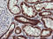 NADH:Ubiquinone Oxidoreductase Subunit B10 antibody, LS-C787432, Lifespan Biosciences, Immunohistochemistry paraffin image 