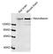 Neurofascin antibody, LS-B14115, Lifespan Biosciences, Western Blot image 