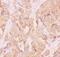 Angio Associated Migratory Cell Protein antibody, PB9123, Boster Biological Technology, Immunohistochemistry paraffin image 