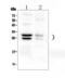 Catechol-O-Methyltransferase antibody, A00464, Boster Biological Technology, Western Blot image 