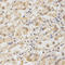 Toll Interacting Protein antibody, LS-C331982, Lifespan Biosciences, Immunohistochemistry paraffin image 