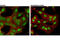 Nuclear Receptor Subfamily 3 Group C Member 1 antibody, 47411S, Cell Signaling Technology, Immunofluorescence image 