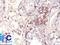 MAGE Family Member A1 antibody, NBP2-33094, Novus Biologicals, Immunohistochemistry paraffin image 