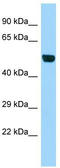 Beta-1,4-glucuronyltransferase 1 antibody, TA341869, Origene, Western Blot image 