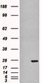 Glutathione S-Transferase Pi 1 antibody, orb19036, Biorbyt, Western Blot image 